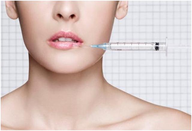 玻尿酸豐唇.jpg