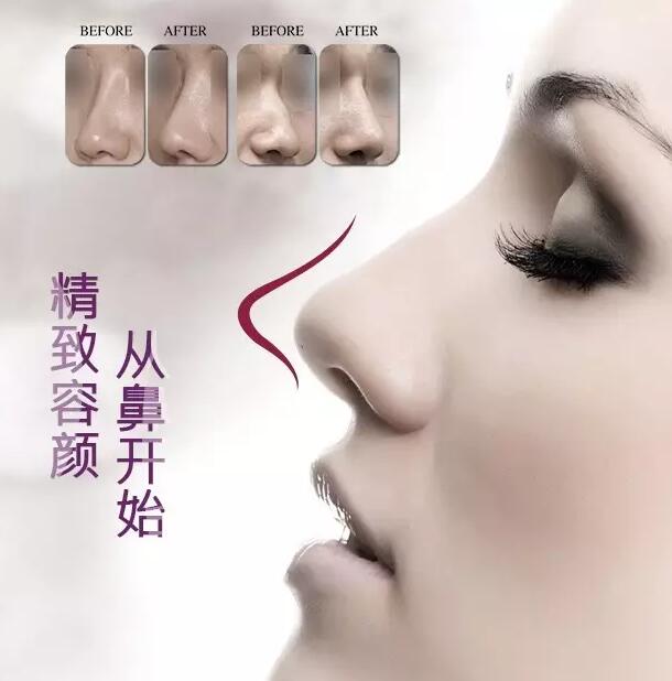 精致容顏，從鼻開始