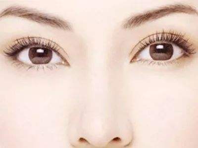 雙眼皮001-林賢超