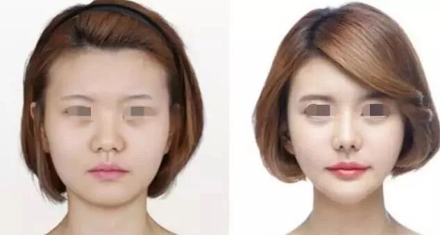 情人節(jié)活動-海南整形3