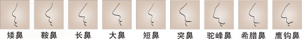 東方人常見缺陷鼻型